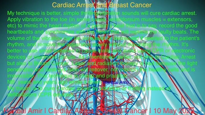 Cardiac Arrest and Breast Cancer, article by Hanbal Amir, 10 May 2025